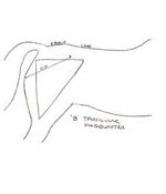 triangular hindquarter.jpg