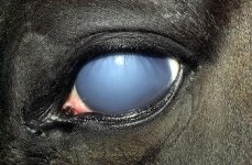 eq_glaucoma.jpg