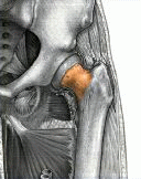 Neck_of_Femur_a.gif