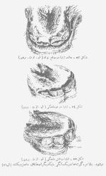 a.gif
